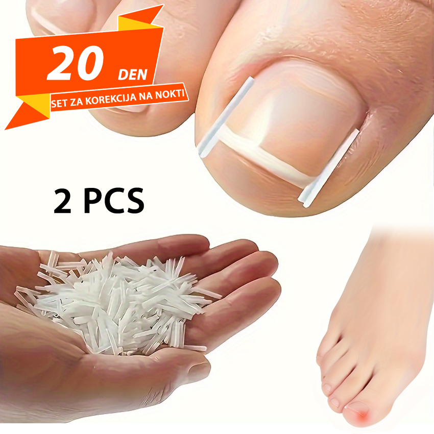 Set za Korekcija na Nokti 2pcs