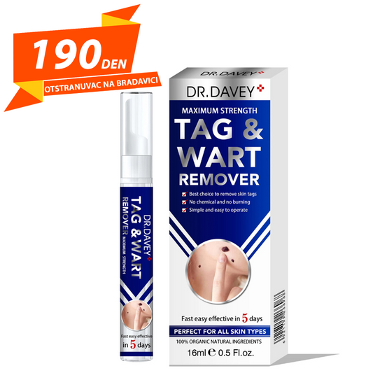 Otstranuvac na Bradavici