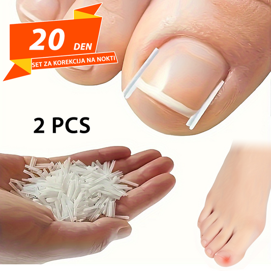 Set za Korekcija na Nokti 2pcs